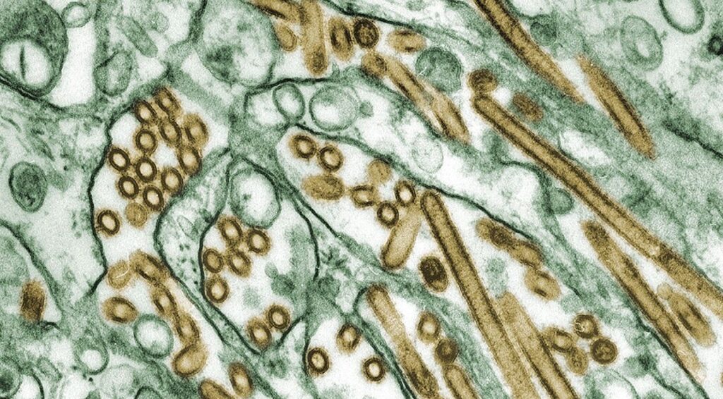 EUA confirmam segundo caso de gripe aviária em humano 6 img 4673 1