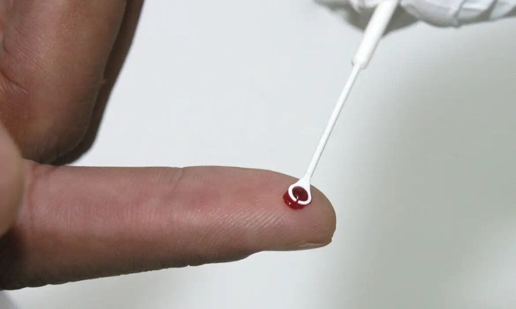 Saúde amplia vacinação contra o HPV para quem usa PrEP 1 img 3512
