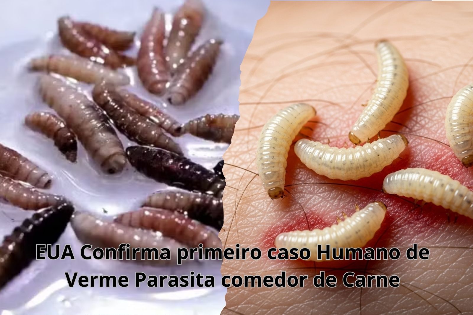 EUA Confirma primeiro caso Humano de Verme Parasita comedor de Carne