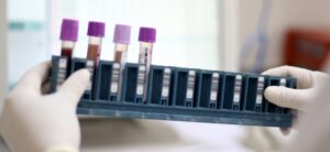 Home 13 0e4563d6 9e71 4cd3 ad42 fa4d38d04b77